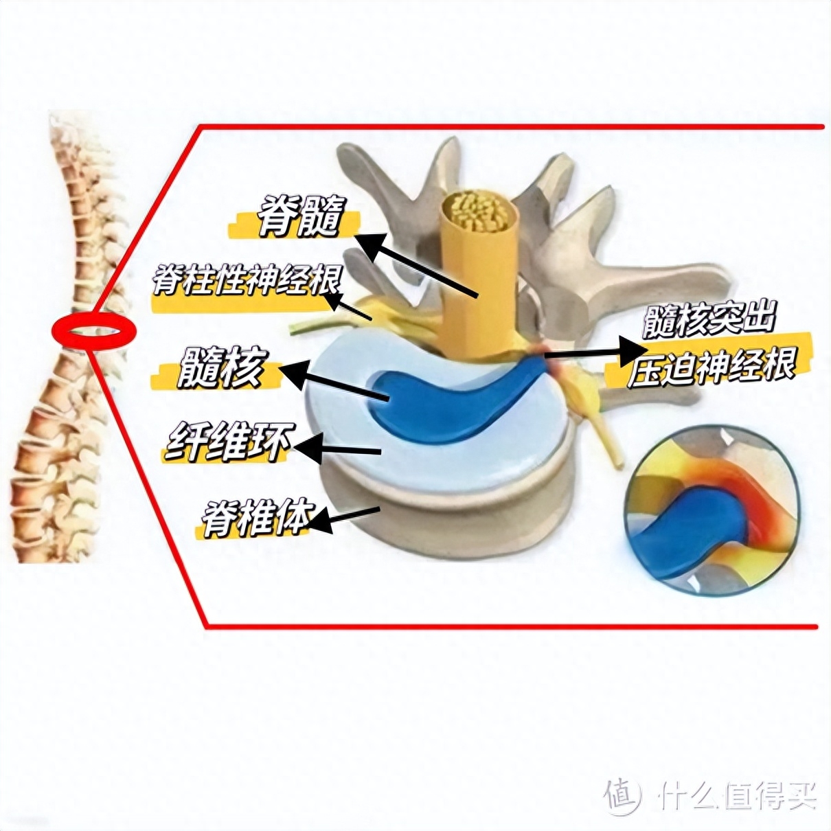 腰部疼痛预防及康复训练__如何预防腰痛病的再次发生